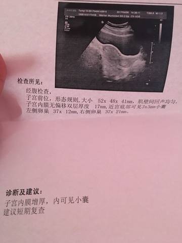 journal_insert_pic_716445784