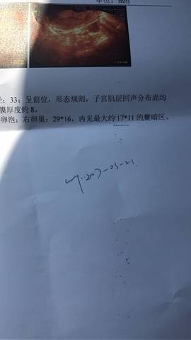 journal_insert_pic_717118356