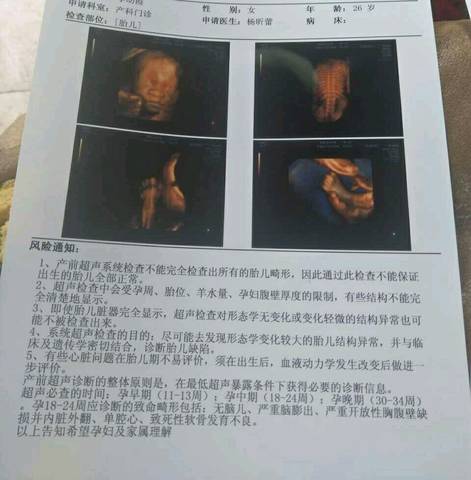 journal_insert_pic_720161148