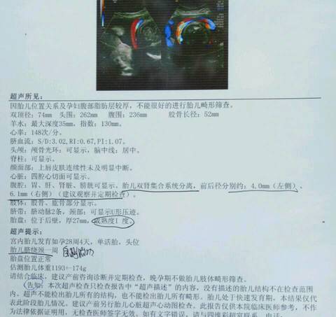 journal_insert_pic_720418556