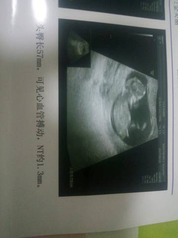 journal_insert_pic_722267336