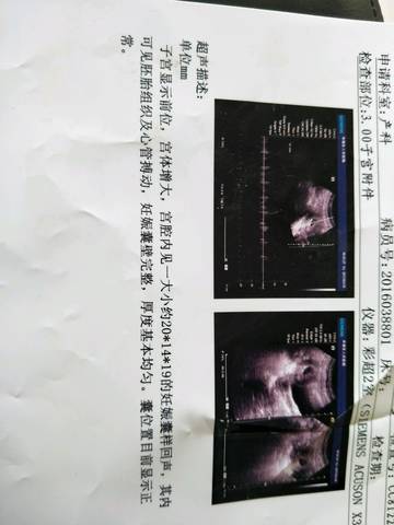 journal_insert_pic_721735878