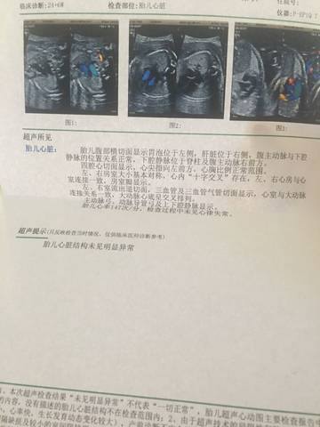 journal_insert_pic_722873028