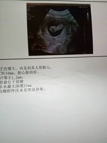 journal_insert_pic_724069918