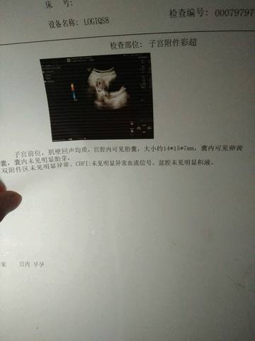 journal_insert_pic_724099734