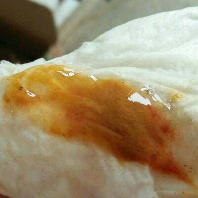 现在有点拉肚子而且带有血丝不是乾的像果冻一样的便看着拉臭臭时疼