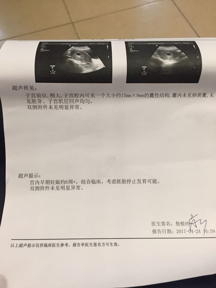 hcg翻倍差，果然没有奇迹