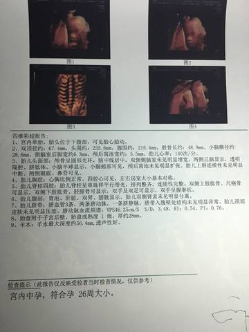 journal_insert_pic_725948773