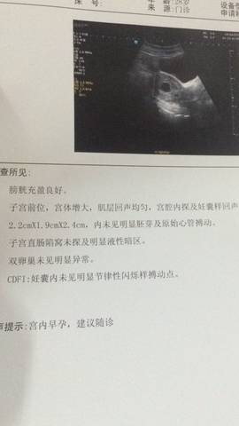 journal_insert_pic_725741721