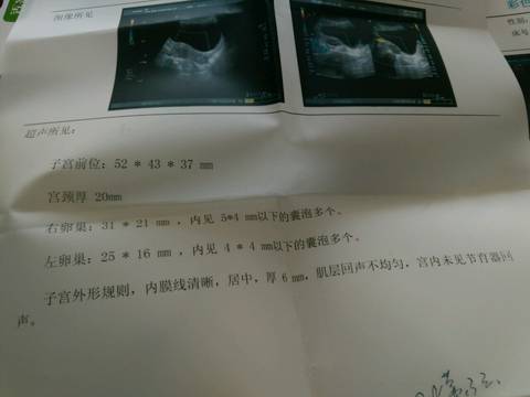 journal_insert_pic_728859549