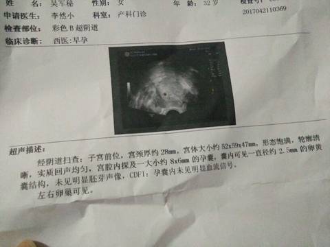 journal_insert_pic_729858409