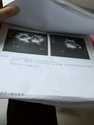 journal_insert_pic_729760405