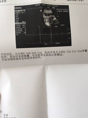 journal_insert_pic_730389399