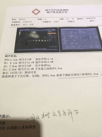 journal_insert_pic_731081472