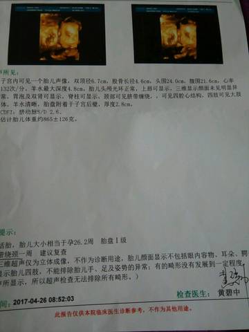 journal_insert_pic_731240715
