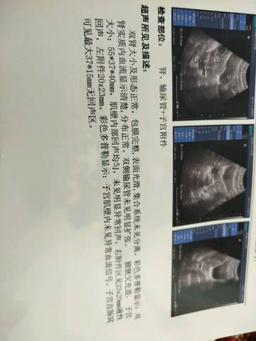 journal_insert_pic_732092686