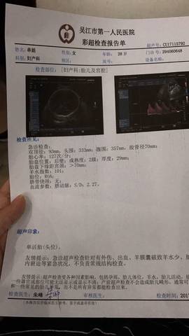 journal_insert_pic_732658276
