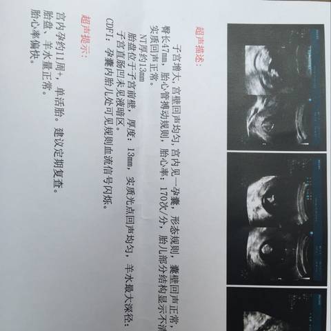 journal_insert_pic_733060261