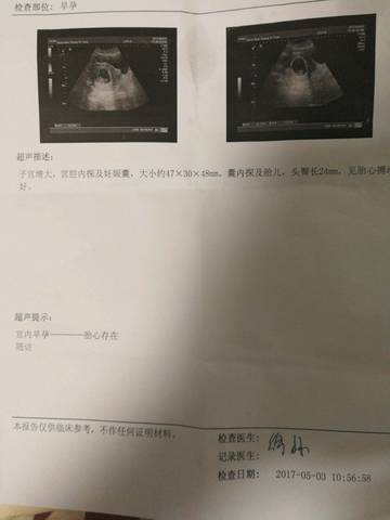 journal_insert_pic_734177797