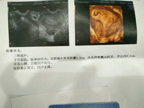 journal_insert_pic_734662121