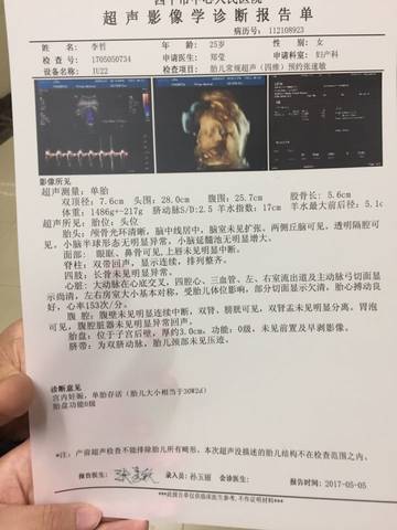 journal_insert_pic_734756459