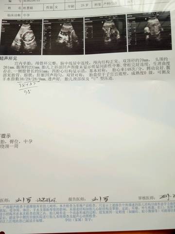 journal_insert_pic_736242714