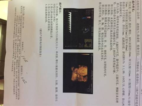 journal_insert_pic_737859591