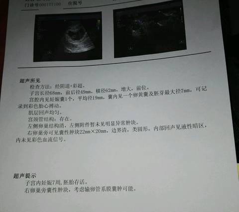 journal_insert_pic_737734728