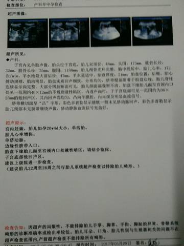 journal_insert_pic_737612995