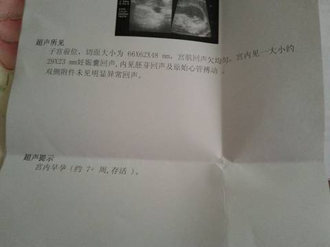 journal_insert_pic_738402525