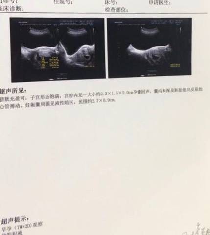 journal_insert_pic_738406989