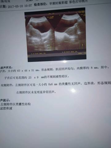 journal_insert_pic_739430219