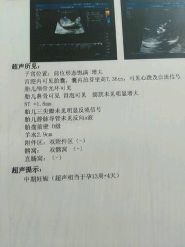 journal_insert_pic_739337508