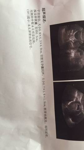 journal_insert_pic_742595447