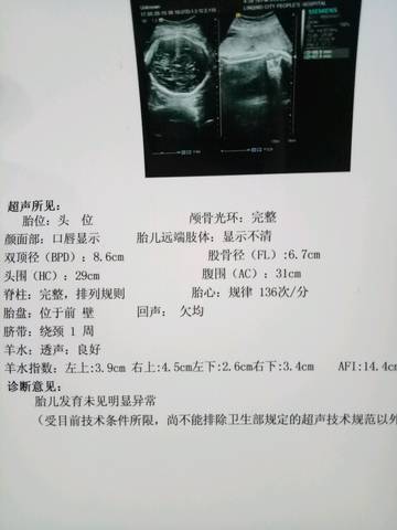 journal_insert_pic_746432082