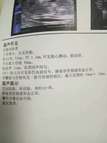 journal_insert_pic_748972089