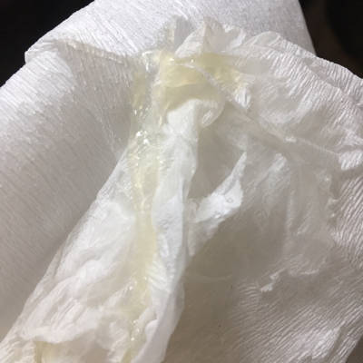 宝妈们知道这是什麼吗?正常吗?好急