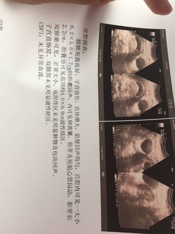 journal_insert_pic_754791165