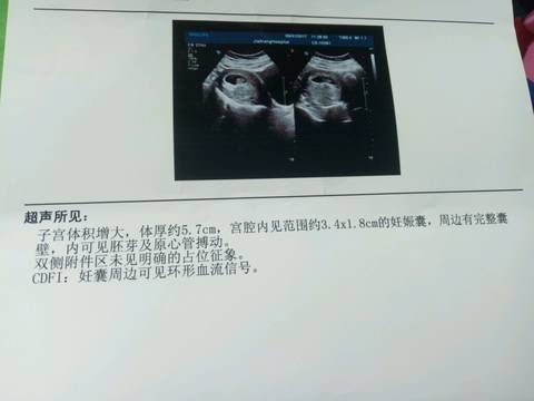 journal_insert_pic_755578011