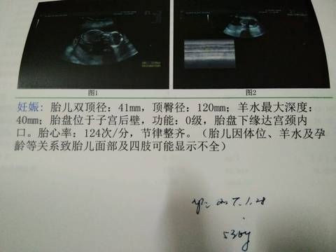 journal_insert_pic_760009613