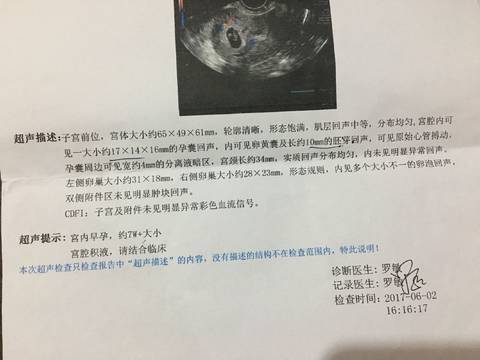 journal_insert_pic_760696024