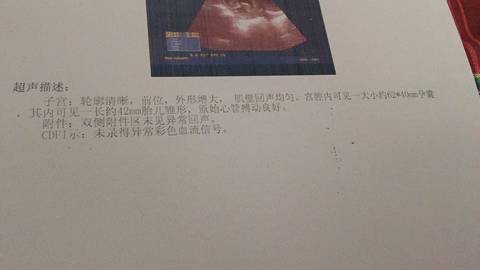 journal_insert_pic_761656305