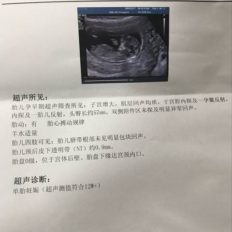 journal_insert_pic_761412940