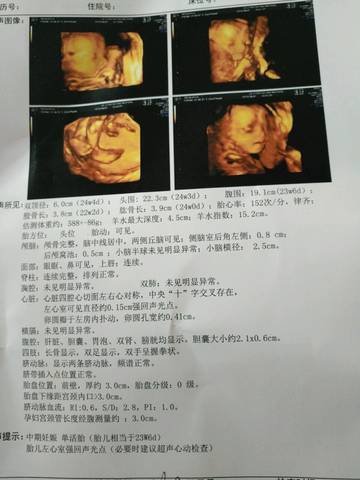 journal_insert_pic_762511365
