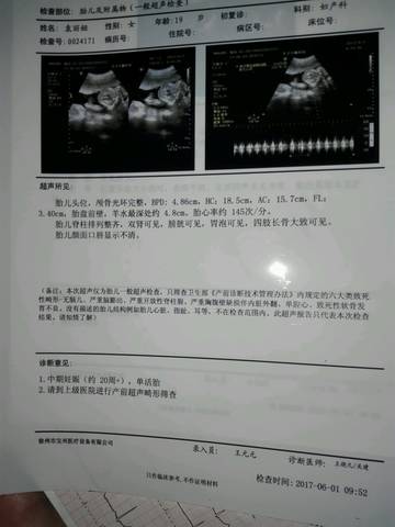 journal_insert_pic_762736648