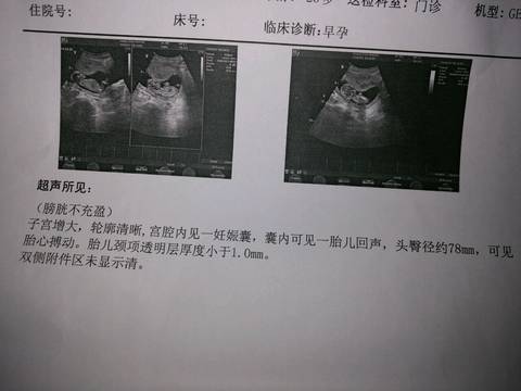 journal_insert_pic_765812539