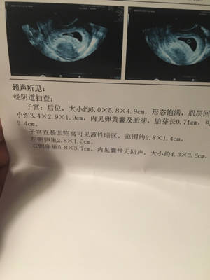 journal_insert_pic_768448092