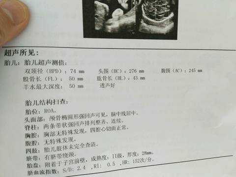 journal_insert_pic_768884045