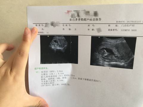 journal_insert_pic_768842074