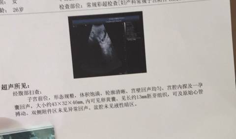 journal_insert_pic_770631685